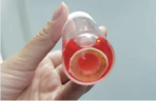 眼表病/角膜病专科